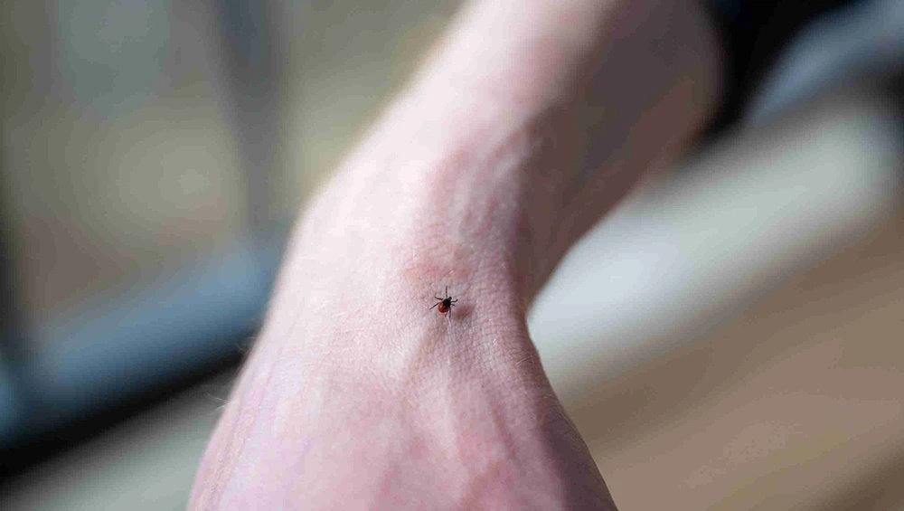 Picture of a limb with a small tick
