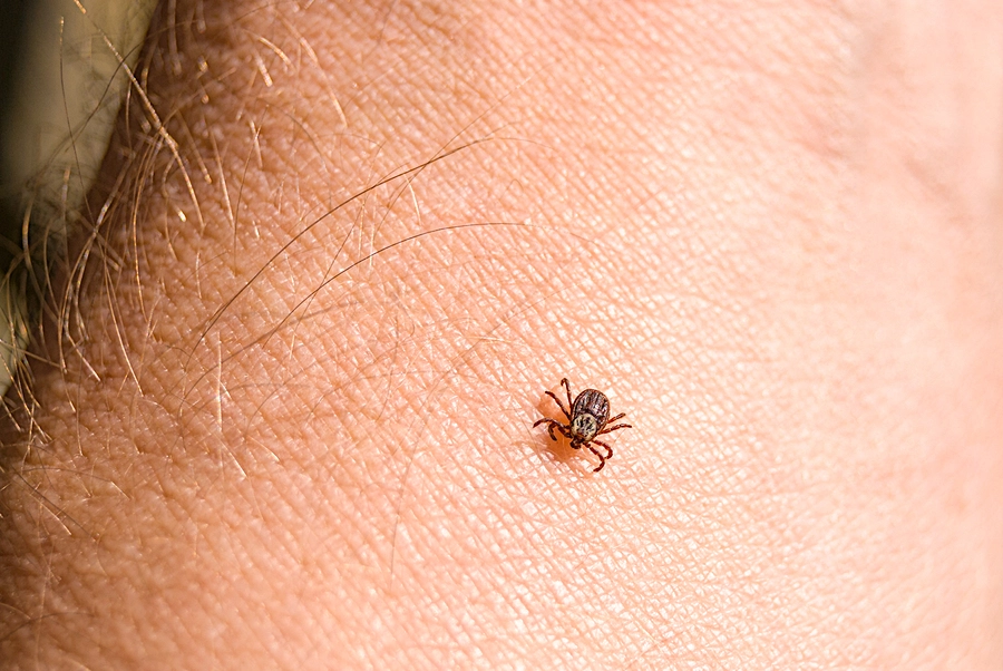 Small tick on a person's arm