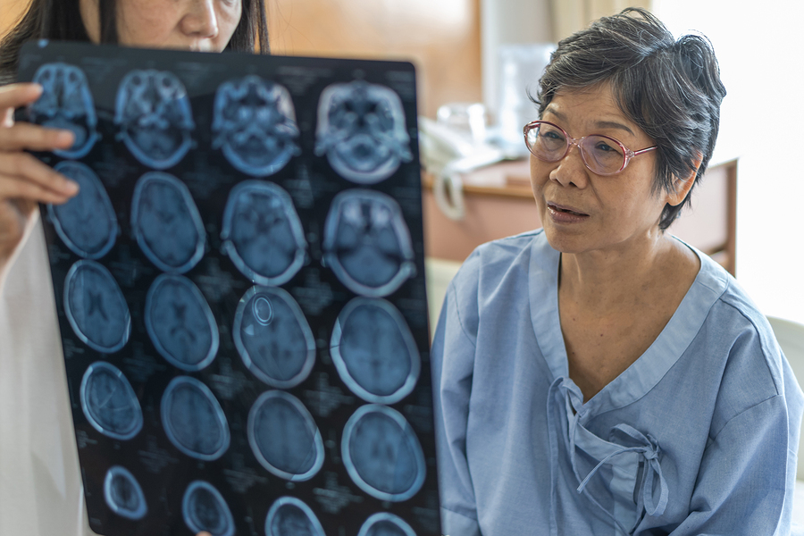 Woman doctor examining MRI of brain scan
