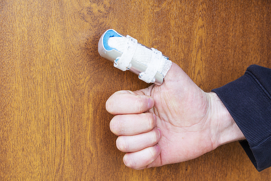 a man's hand with a broken thumb wrapped in bandages and splinted